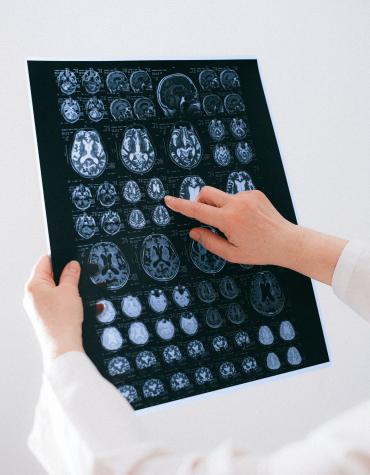 Person pointing at brain x-rays